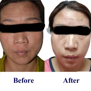ผลิตภัณฑ์ฟื้นฟูผิวด้วยคริสตัลแพลเท็กซ์ pdrn สำหรับร้านเสริมสวย - Product Image 6