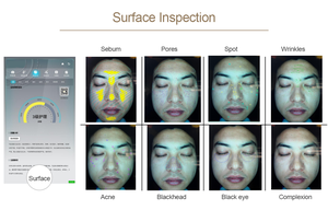 2025 Escáner facial Analizador de piel AI Inteligente Colorido 3D Imagen digital Diagnóstico Máquina de análisis de piel - Product Image 6
