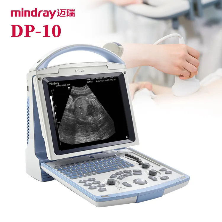 Mindray DP-10 ultrason makinesi tıbbi ecografo portatil tam dijital b ultrason makinesi