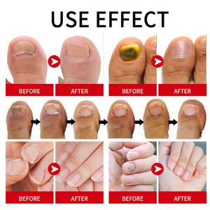 สาระสำคัญของการดูแลเล็บซ่อมแซมสำหรับเล็บสีเหลืองและหนาการรักษาให้ความชุ่มชื้นสำหรับเล็บที่เสียหาย - Product Image 2