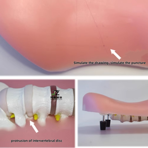 Transforaminal Endoscope Simulation <strong>Human</strong> <strong>Back</strong> Model TESSYS Model Lumbar Disc Herniation Training Model - Product Image 2