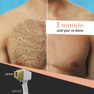 น้ำแข็งมืออาชีพ755nm 808nm 1064nm ไดโอดทองคำขาวเลเซอร์บิ๊ก Pow 1600W 1800W น้ำแข็งเลเซอร์กำจัดขนราคาเครื่อง - Product Image 2