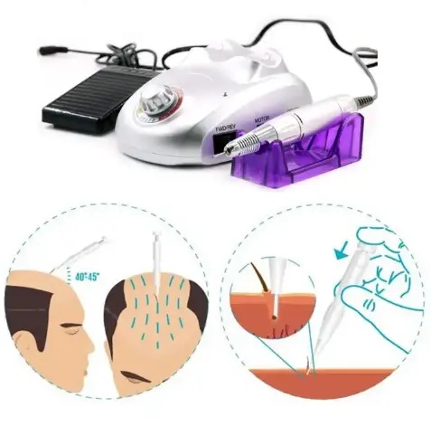 Hair Growth Machine To Trichology And Dermatology Medical Clinics robotic hair transplant machine fue
