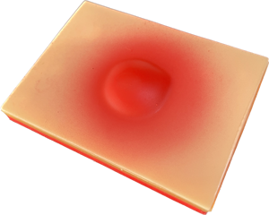 Piel realista de simulación médica de PVC para entrenamiento de incisión y drenaje de abscesos Entrenamiento de simulación médica para abscesos - Product Image 5