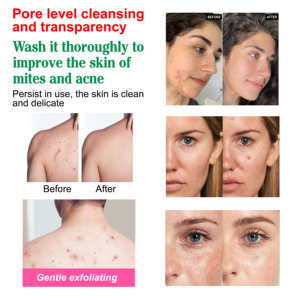 DR.DAVEY <strong>SOAP</strong> Niacinamide Brightening Moisturizing Scrub <strong>Soap</strong> Tumeric and Kojic Acid <strong>Soap</strong> - Product Image 3