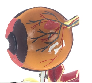 Medical Science <strong>Human</strong> Pathology Model Hypertension Anatomical Model High Blood Pressure Model - Product Image 5