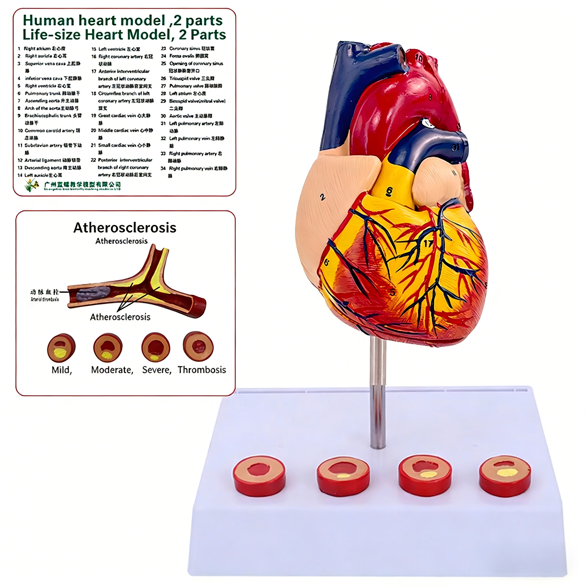 Modelo de corazón humano de tamaño natural con trombo