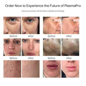 Newest Technology Cold <strong>Plasma</strong> Fractional <strong>Plasma</strong> Machine Cool Jet <strong>Plasma</strong> For Face