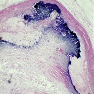 <strong>Microscope</strong> <strong>Slides</strong> <strong>of</strong> Pathology Prepared <strong>Slides</strong> <strong>Microscope</strong> Teaching Biology Science 100pcs Packed in <strong>Slide</strong> Box - Product Image 3