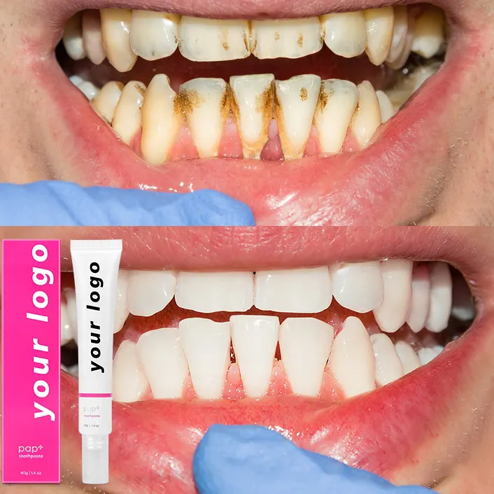Dentifricio di migliore qualità di vendita caldo senza fluoro per Pap sensibile + Formula sbiancante per denti personalizza Logo PAP dentifricio