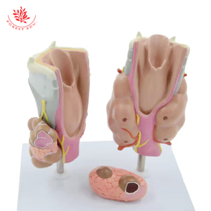 Anatomical Model High Quality Medical <strong>Thyroid</strong> Pathological Model 4 Parts <strong>Thyroid</strong> Throat Anatomical Model
