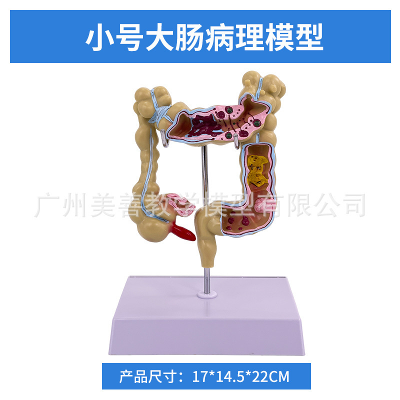 Colon pathological model (small size) 17*14*22