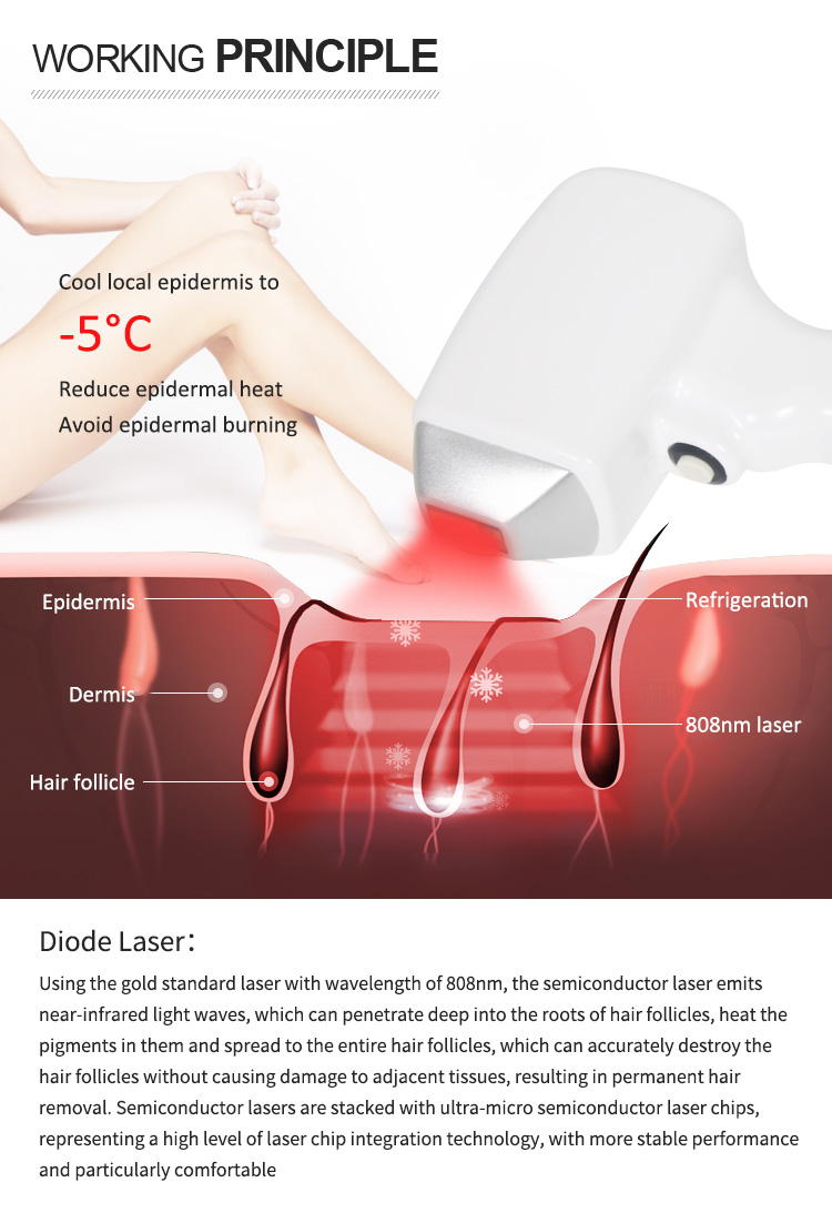 New machine diode laser 755 808 1064 hair removal picosecond laser tattoo removal machine 808nm pico second