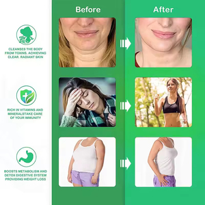 OEM/ODM Label pribadi Gummies lumut laut dengan pisau cukur akar Burdock Vegan lumut laut organik Gummies untuk kulit sehat, Detox - Product Image 4