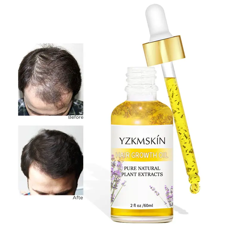 Formula organik minyak rosemary penguat cepat pertumbuhan rambut untuk semua jenis rambut mempercepat pertumbuhan rambut minyak perawatan alami murni