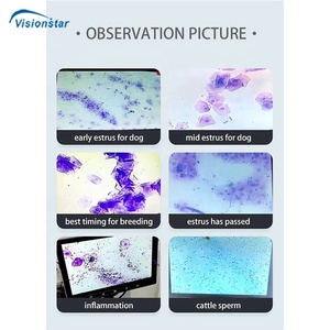 Microscopio biológico con pantalla digital binocular óptica de laboratorio médico para clínica veterinaria - Product Image 4