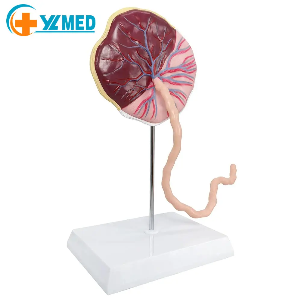 Placenta Umbilical Cord Anatomical Model Life Size Umbilical Cord Placenta Model with Veins Arterial Embryo Tissue Structure