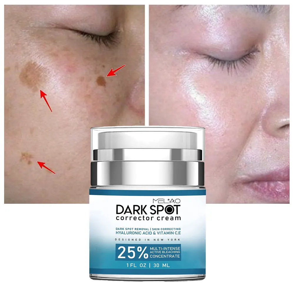 Nhãn hiệu riêng Hàn Quốc Dark Spot loại bỏ kem chống lão hóa Làm Trắng Mặt kem cho đốm đen loại bỏ