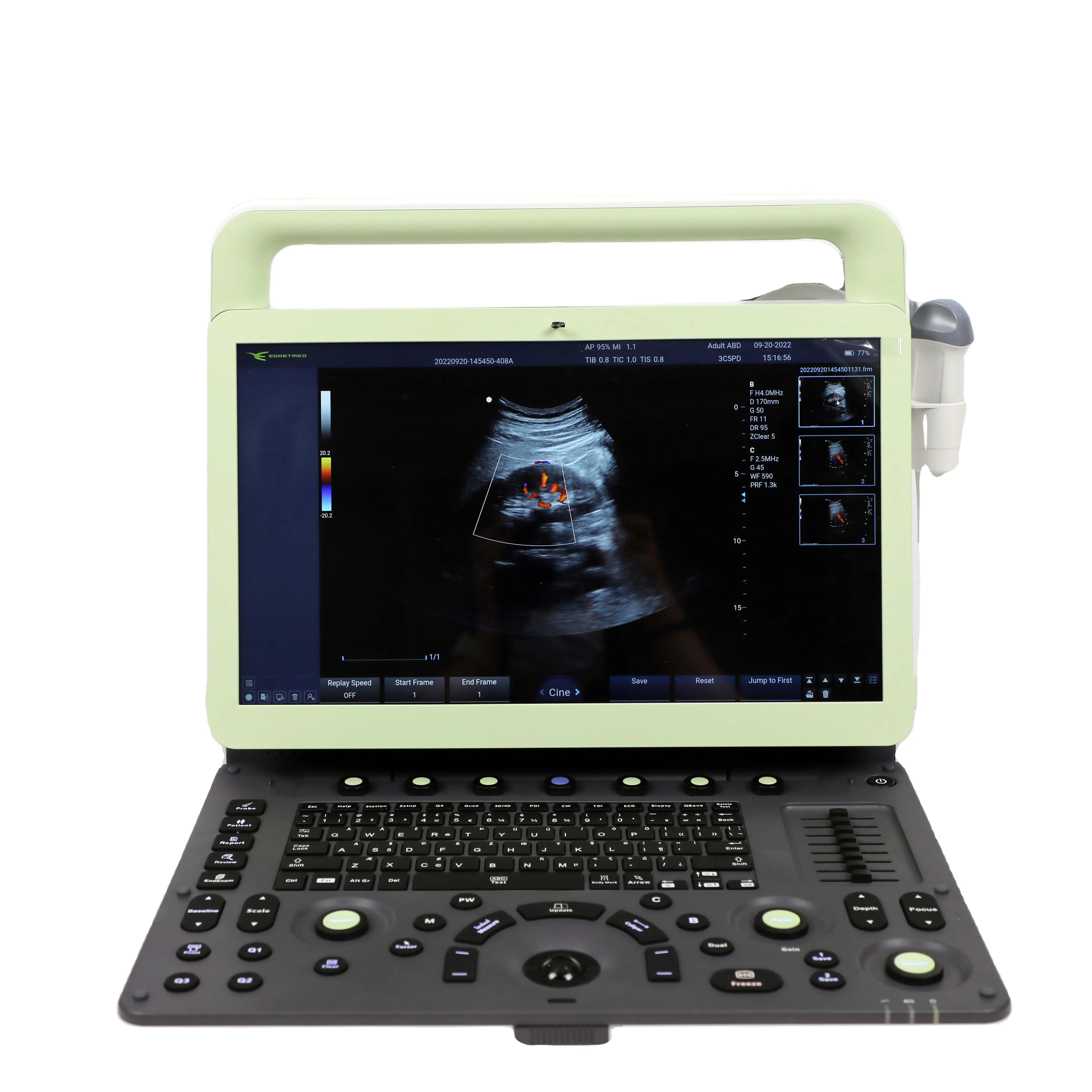 Máquina de ultrassom do doppler da cor cw para venda