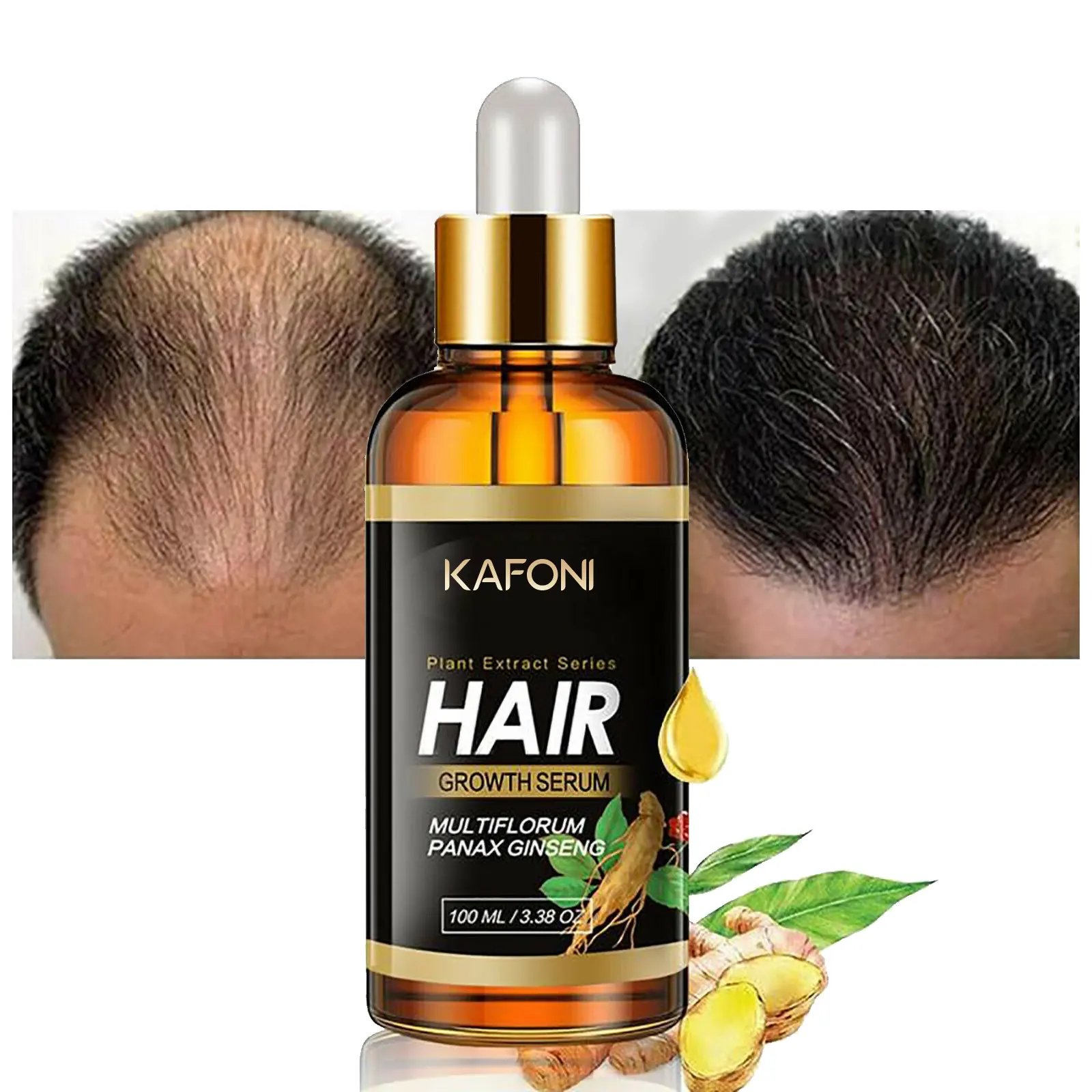 Hair Treatment Serum Wholesale Custom Herbal Anti Hair Loss Boosting Hair Growth Oil