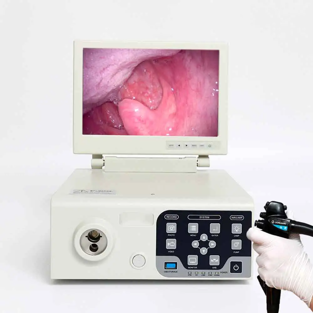 Prezzo a buon mercato portatile ospedale medico veterinario endoscopio telecamera endoscopio gastroscopio colonoscopio cavallo cane
