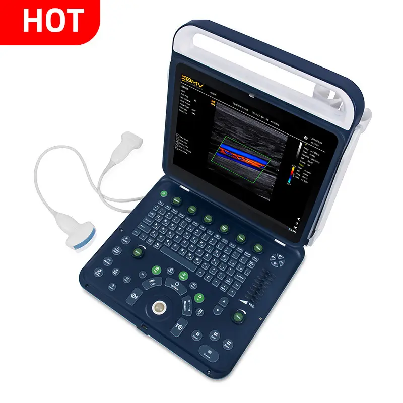 Máquina de ultrasonido portátil para diagnóstico de embarazo, máquina de ultrasonido con Doppler a Color de 15 pulgadas