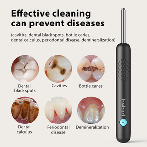 Bebird Thiết bị kiểm tra sức khỏe khoang mũi miệng thông minh dụng cụ vệ sinh ống tai thông minh máy ảnh ghi hình khoang răng R1 - Product Image 4