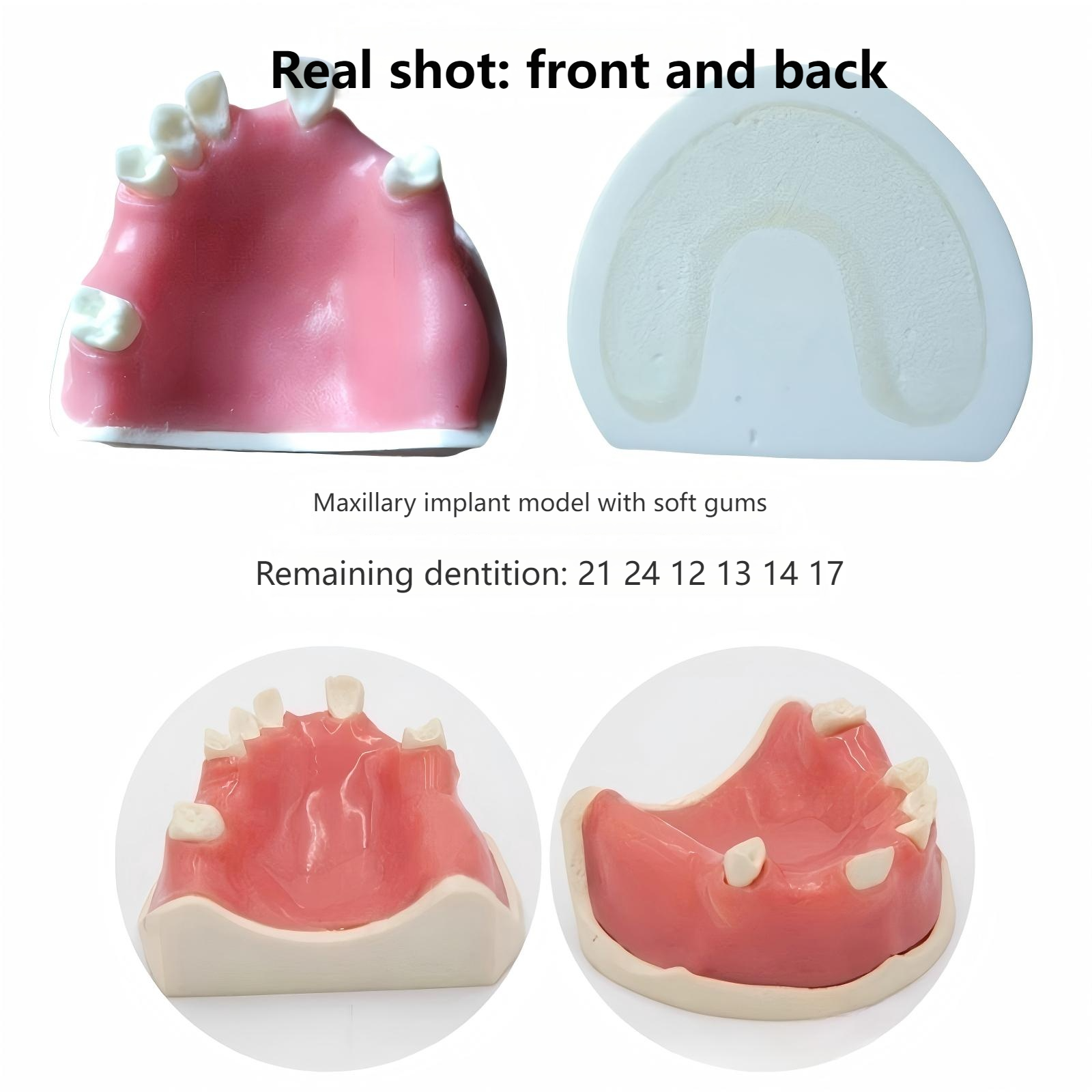 Modelo de implante para defecto maxilar blanco POS-01