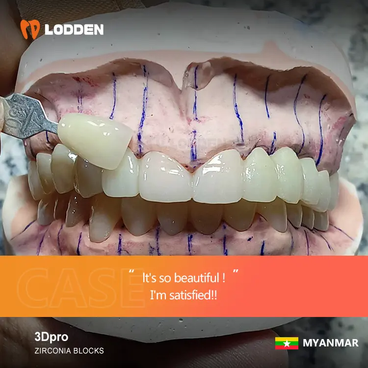 Cakram zirkonia restorasi estetika CADCAM zirconia blok multilayer 3Dpro zirconia untuk lab gigi