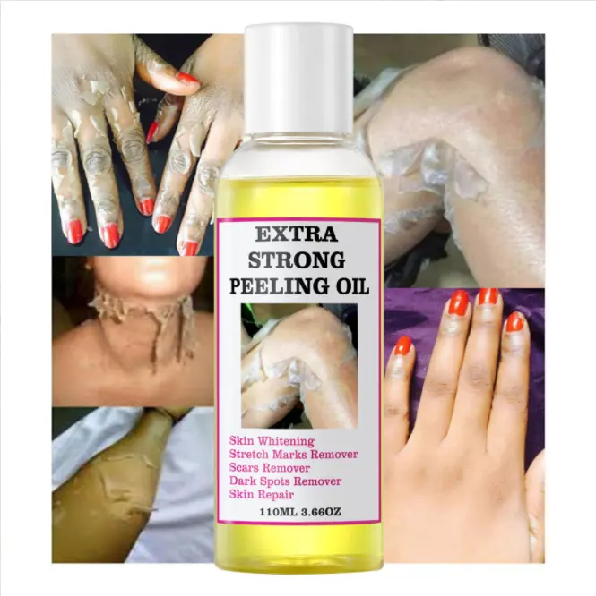 Aceite de Peeling amarillo OEM, vitamina C, blanqueamiento de nudillos, hidratante, eliminación de manchas oscuras, aceite de Peeling extrafuerte
