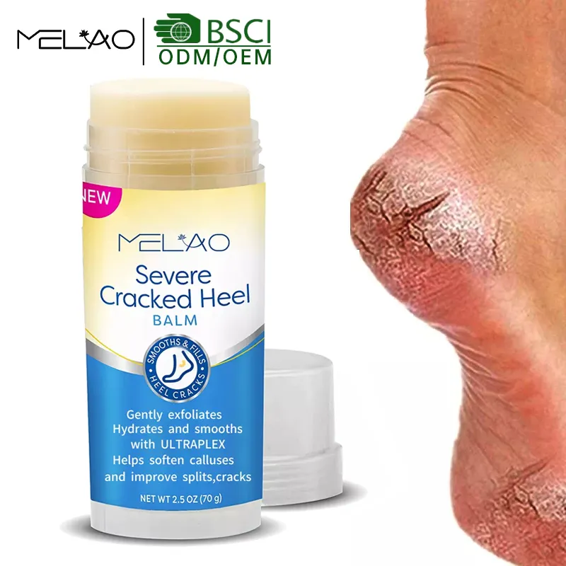Logo personalizzato Private labell foot peeling cream idratante Repair Foot Cream per Peel Crack 40% Urea Foot Cream balm