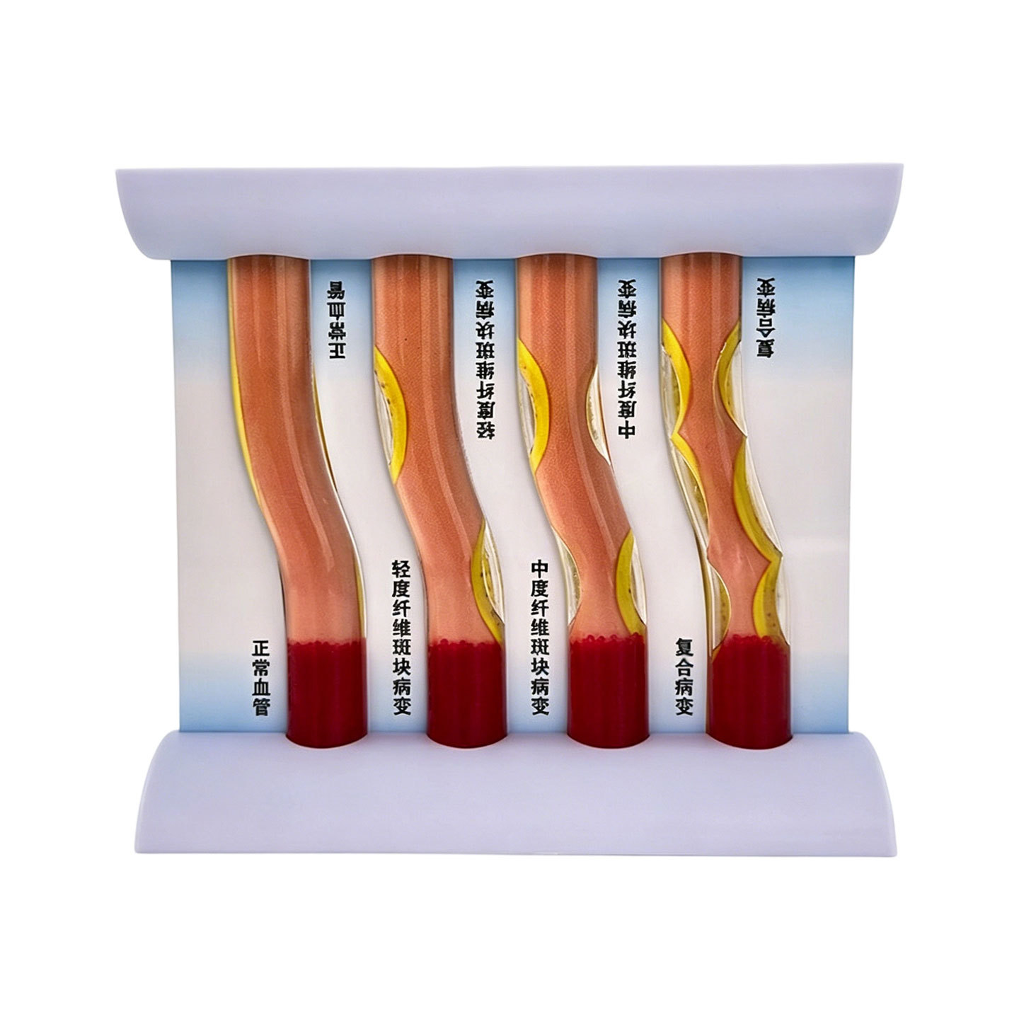 Four-Limb Dynamic Vascular Occlusion Model - Chinese Version