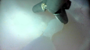 Simulateur de formation en uthéroscopie médicale pour l'enseignement du modèle d'orgue urinaire panier en filet pour extraction de pierre - Product Image 6