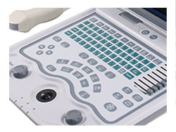 Tıbbi ultrasonik ekipman tam dijital B/W modu ultrason tarayıcı taşınabilir ultrasonografi makinesi <span class=keywords><strong>KX5600</strong></span>