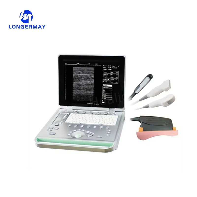 Portable ultrasound scanner vet veterinary equine ultrasound sonoscape equipment