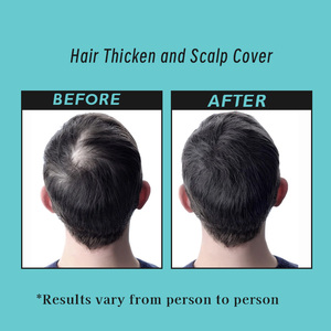 High Quality Hair Growth Capsules for Men with Ashwagandha and Saw Palmetto Improve Hair Growth Help Reduce Hair Shedding - Product Image 5