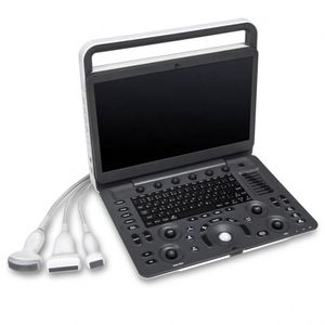 Sonoscape E3 E3V Clínica Veterinária Cor Humana Doppler Ultrassom Máquina Cardíaca PW CW - Product Image 1