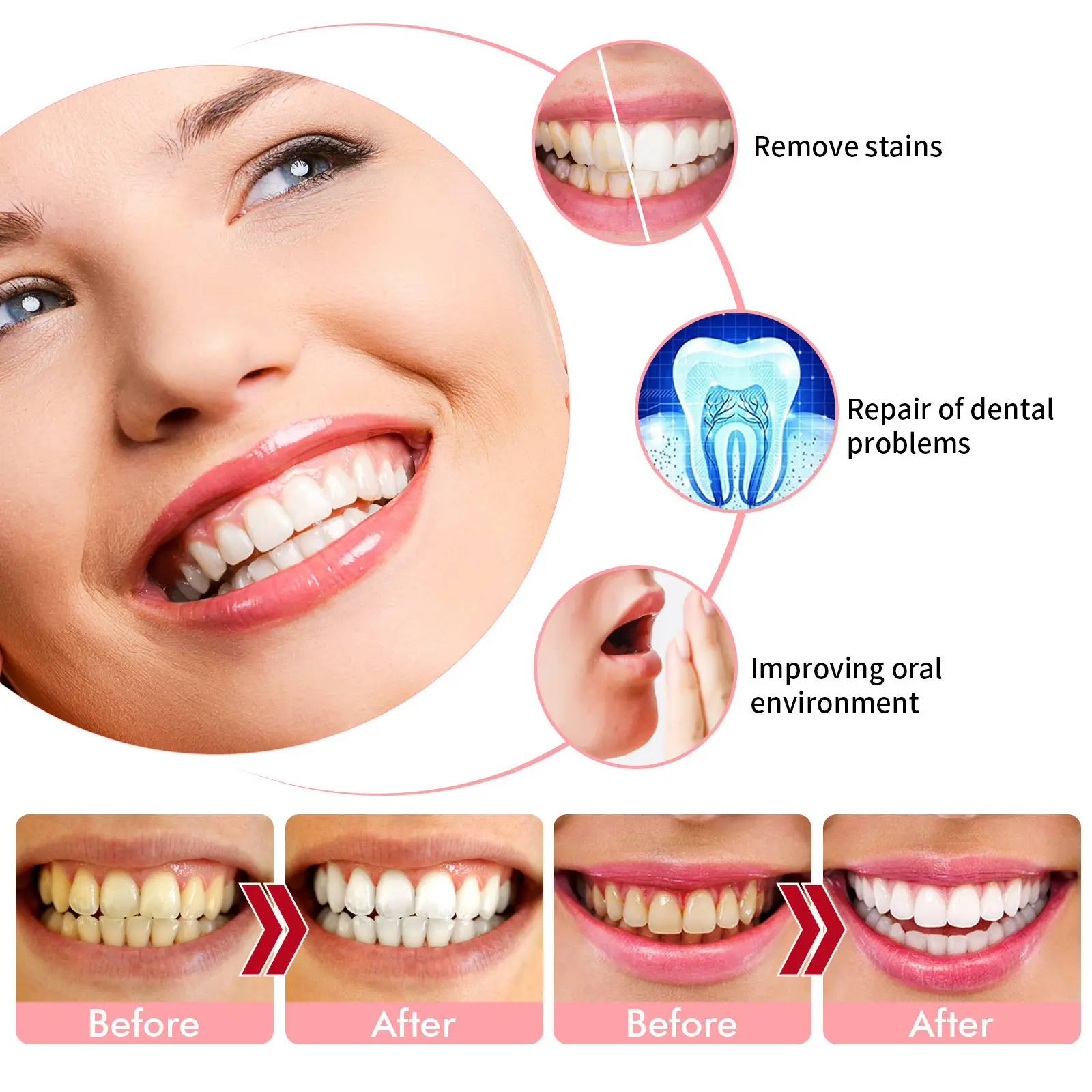 Aking-prensa para blanquear los dientes, pasta de dientes con sabor a fruta de baya, limpieza oral