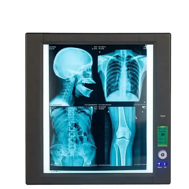 Ospedale doppio led x-ray visore scatola luminosa per pellicola medica o pellicola a raggi X
