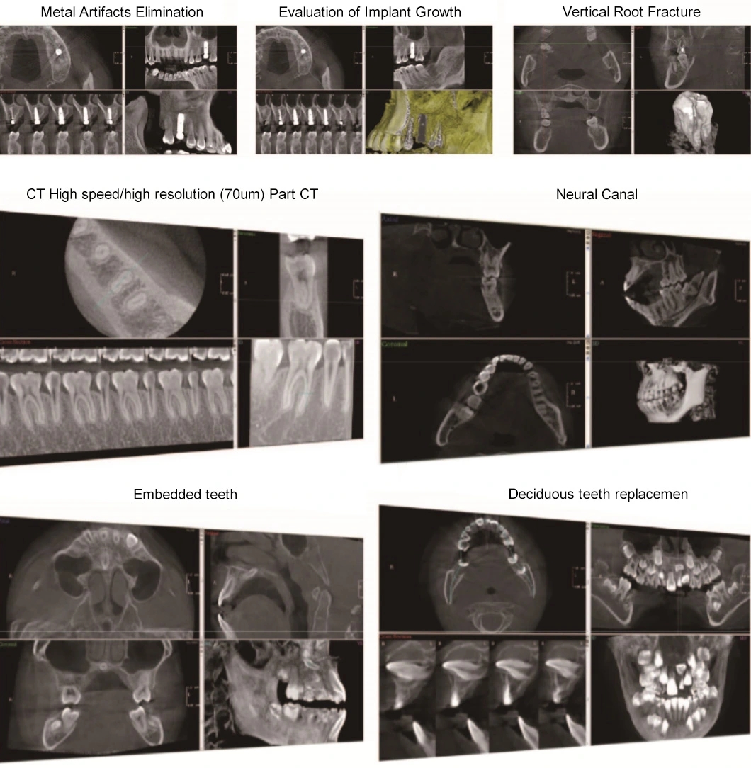 Digital Radiography Panoramic Dental X Ray Machine 5 Hb2b76be7ce1a423db4d3b9c6da4f5ab9O