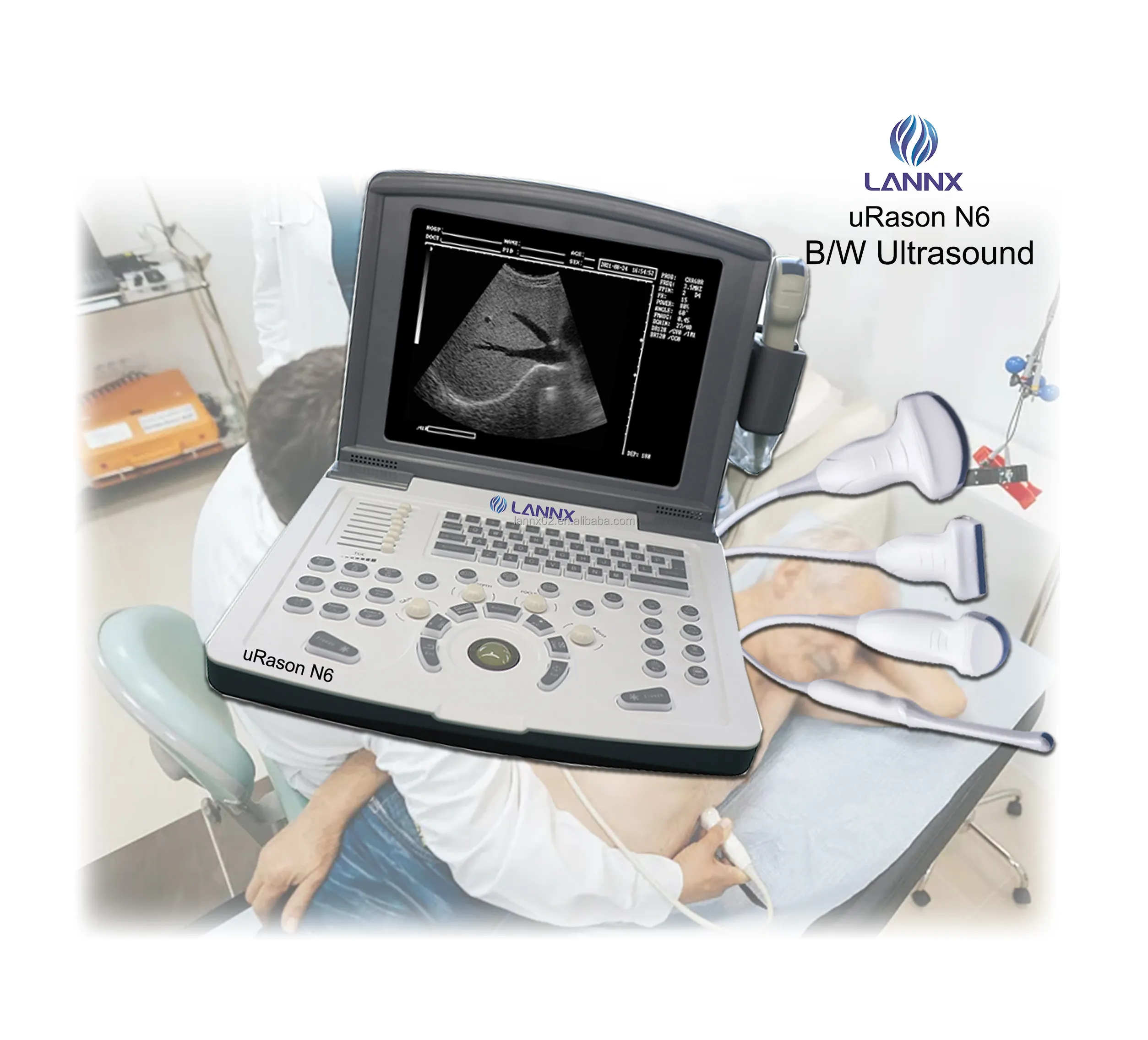 LANNX uRason N6 Pantalla de alta definición Ecocardiografía Sistema de diagnóstico ultrasónico digital completo Máquina de ultrasonido B/W