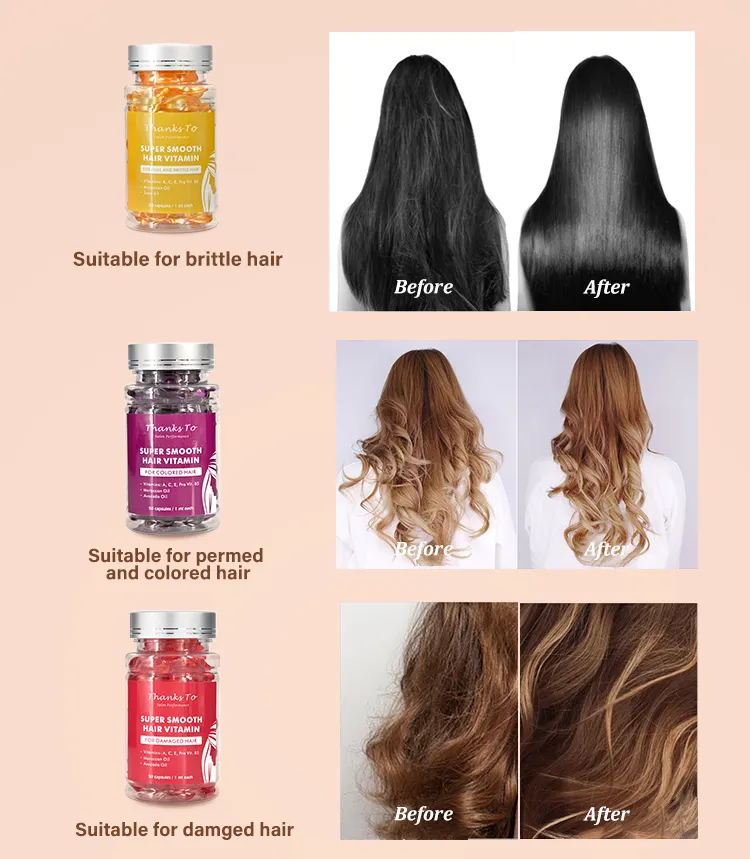 Best Seller Private Label biotina Capsule olio per capelli vitamina ricrescita siero organico Anti perdita di capelli Gummies capelli vitamina capsula
