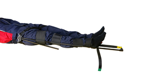 Fabriek Direct Aluminium Been Tractie Spalk Draagbaar Verstelbaar Ontwerp Voor Ambulance En Ziekenhuis Gebruik - Product Image 2