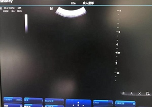 Redelijk Gebruikte Mindray Ultrasone Transducer 3c5a Voor Mindray DC-3, DC-6 - Product Image 3