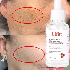 Glutathion Koji säure Serum Vitamin C Aufhellende Sommersprossen Entfernen von Gesichts serum Aufhellung behandlung OEM/ODM - Product Image 2