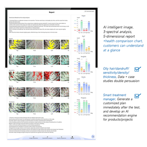 Meiboyi Máy tính để bàn UV ánh sáng trắng không dây Wifi phân tích da đầu với ống kính có thể thay thế Máy phân tích tóc Thẩm mỹ viện phòng khám - Product Image 4