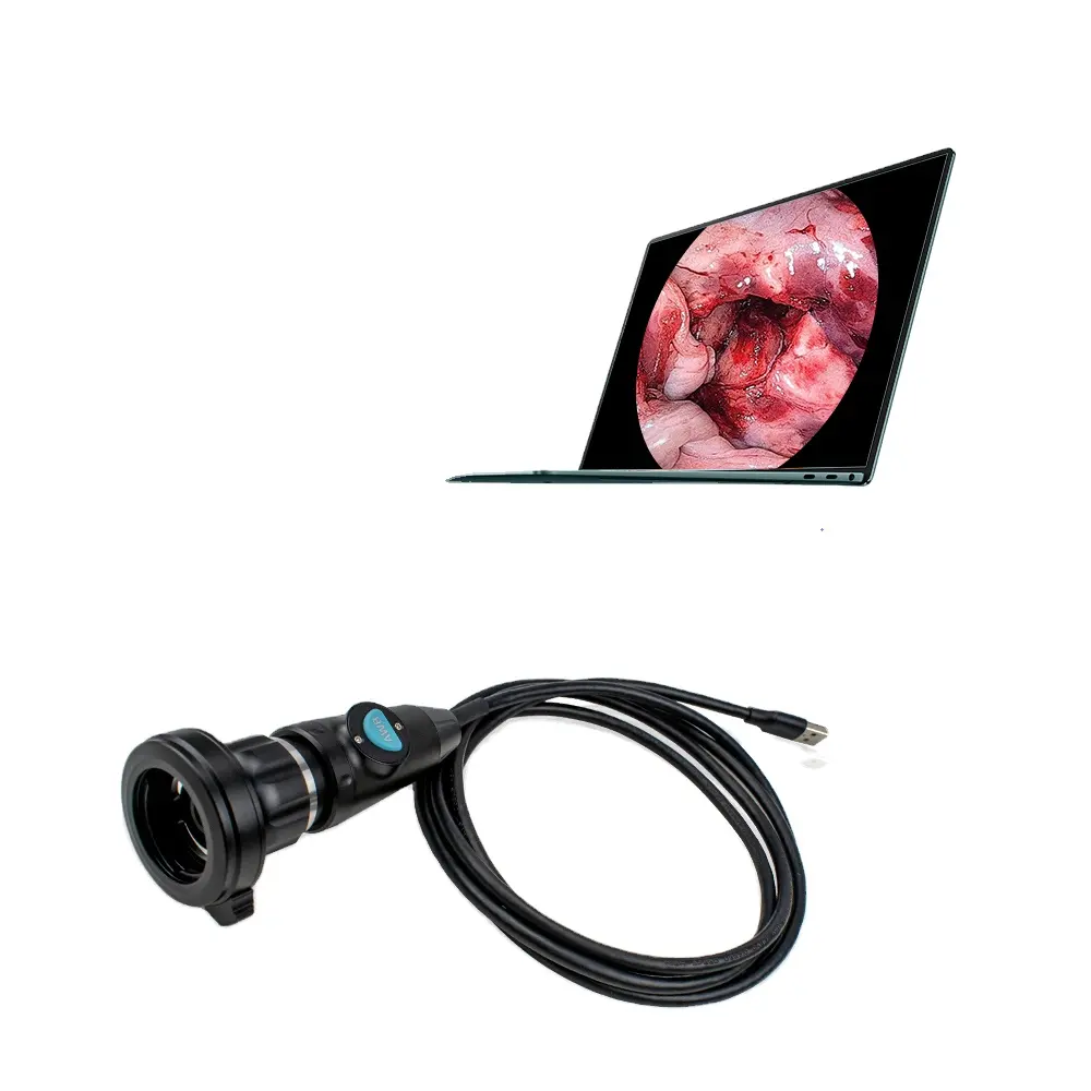 מצלמה ניידת מסוג USB מלא HD אנדוסקופי לנסיעות