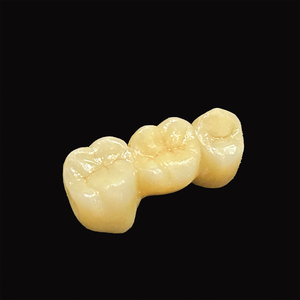 Özelleştirilmiş kaliteli zirkonya diş Crowns ve köprü porselen zirkonya ucuz fiyat kaynaşmış - Product Image 1