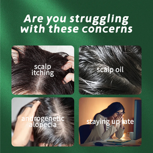 Màu Xanh Lá Cây Xà Phòng Lá Gội Đầu Solide Tự Nhiên Rắn Tóc Dầu Gội Thanh Xà Phòng Cho Rụng Tóc Không Có Bao Bì - Product Image 4