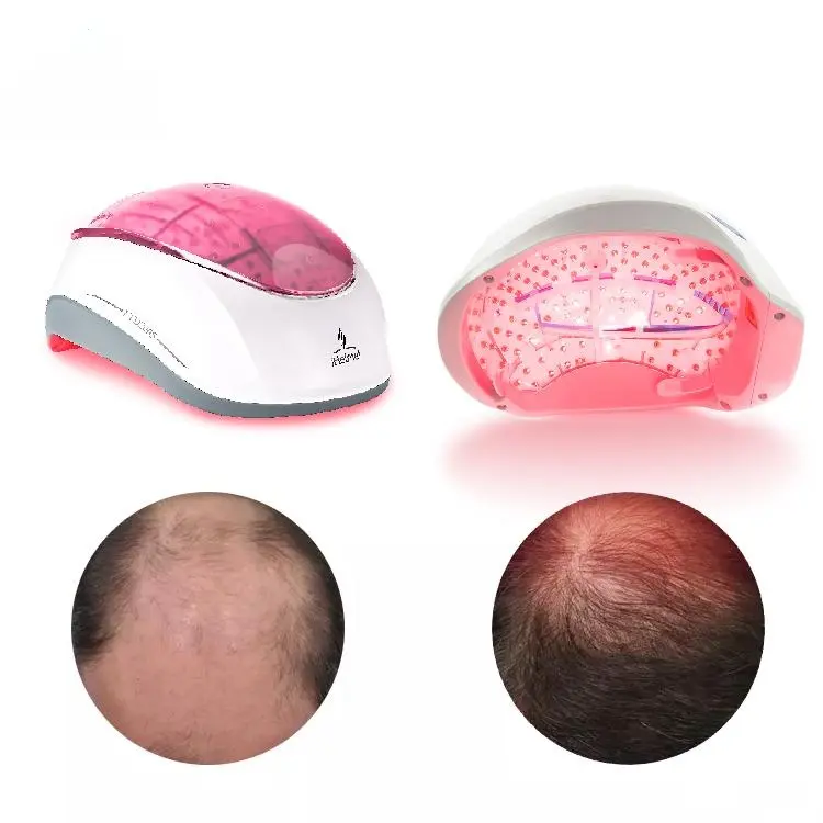 Casco Láser de Diodo para uso doméstico al por mayor de fábrica, sombrero para el crecimiento del cabello, para el cuidado del SPA del cuero cabelludo, tratamiento para el cabello